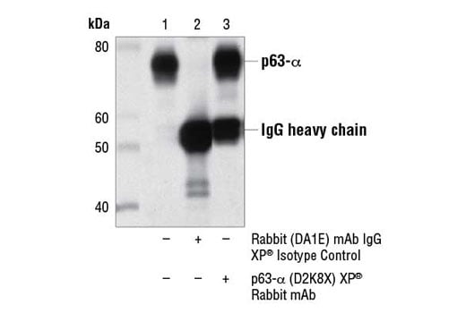 Immunoprecipitation Image 1: p63-alpha (D2K8X) Rabbit Monoclonal Antibody