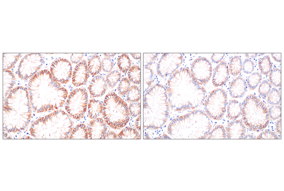 Immunohistochemistry Image 8: MCT1/SLC16A1 (E7A2K) Rabbit Monoclonal Antibody