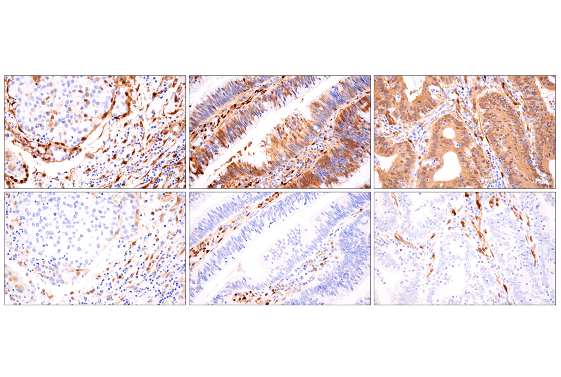 Immunohistochemistry Image 4: YAP (D8H1X) Rabbit Monoclonal Antibody