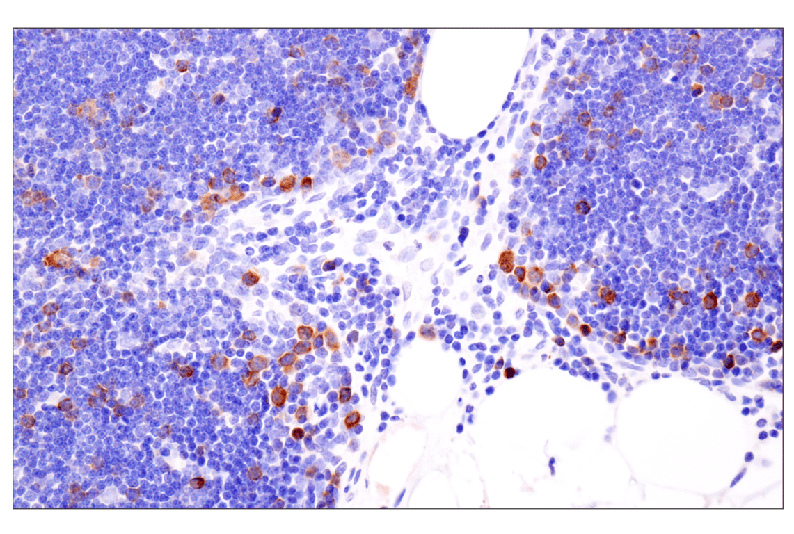 Immunohistochemistry Image 7: Cyclin B1 (F7U1O) Rabbit Monoclonal Antibody