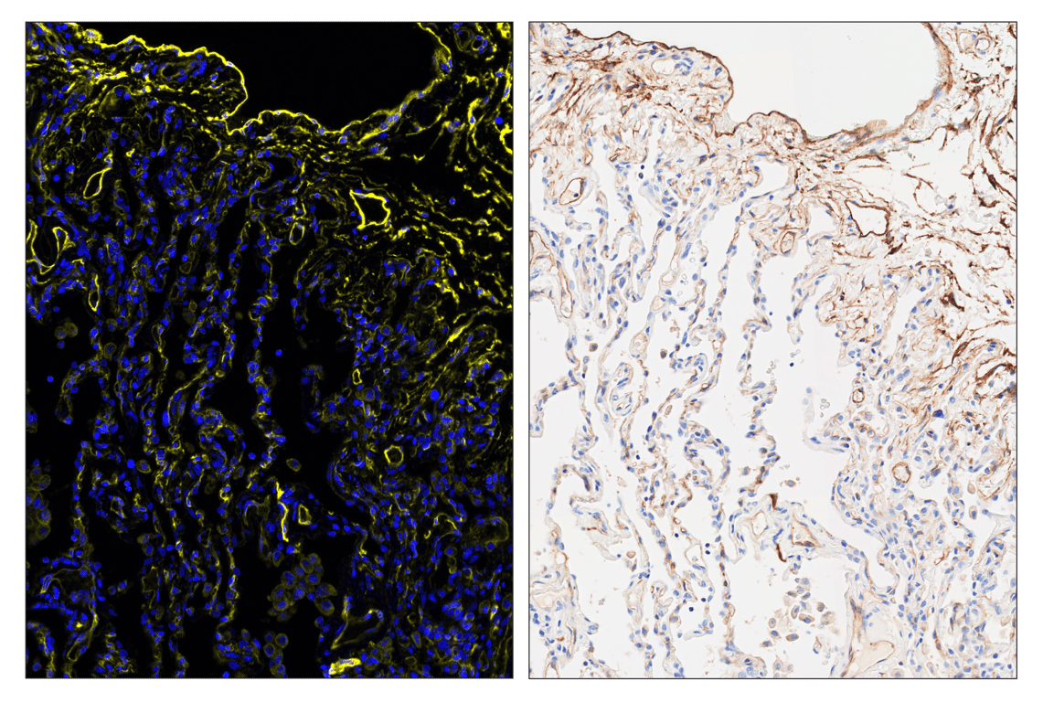 Immunohistochemistry Image 6: NT5E/CD73 (D7F9A) & CO-0039-594 SignalStar<sup>™</sup> Oligo-Antibody Pair