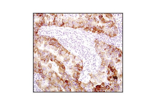 Immunohistochemistry Image 1: EGF Receptor (D38B1) Rabbit Monoclonal Antibody (BSA and Azide Free)