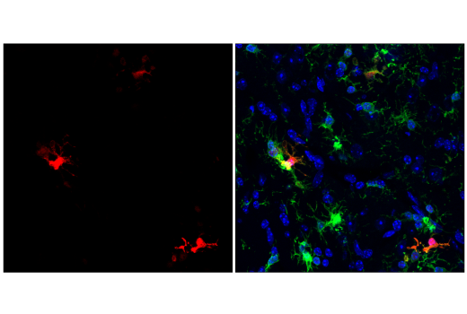 Immunofluorescence Image 2: Galectin-3/LGALS3 (E7B6R) Rabbit Monoclonal Antibody (BSA and Azide Free)