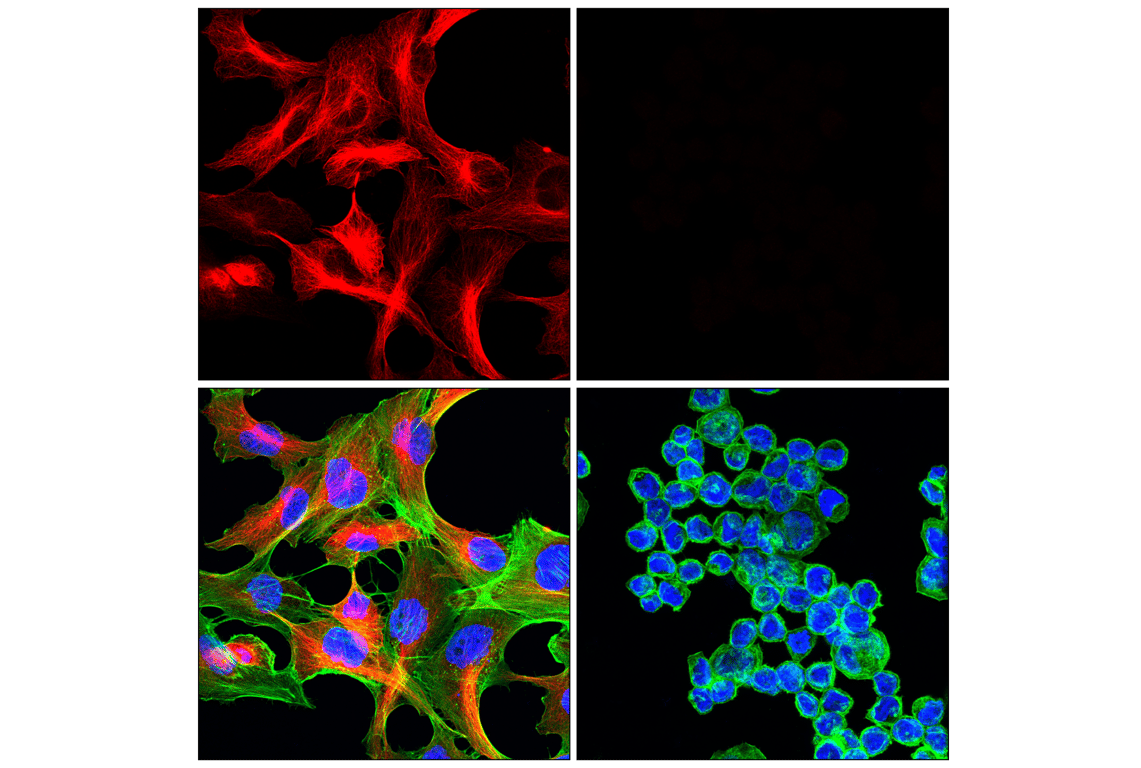 Immunofluorescence Image 1: beta3-Tubulin (E9F3E) Mouse Monoclonal Antibody (Alexa Fluor<sup>®</sup> 647 Conjugate)