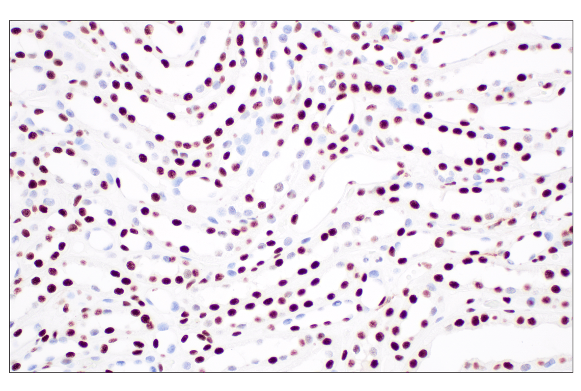 Immunohistochemistry Image 5: NPM1 (E7W4P) Rabbit Monoclonal Antibody