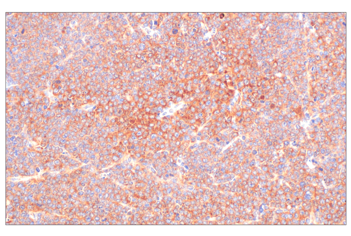 Immunohistochemistry Image 5: PABP1 (F6G6L) Rabbit Monoclonal Antibody