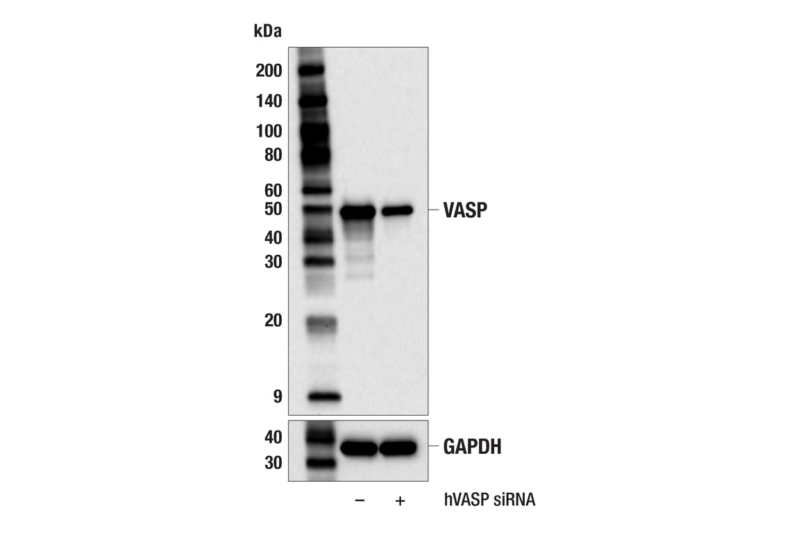 Western Blotting Image 2: VASP (F3S3F) Rabbit Monoclonal Antibody