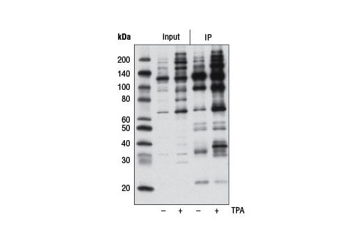 Immunoprecipitation Image 1: Phospho-PKC Substrate Motif [(R/K)XpSX(R/K)] MultiMab<sup>®</sup> Rabbit Monoclonal Antibody mix