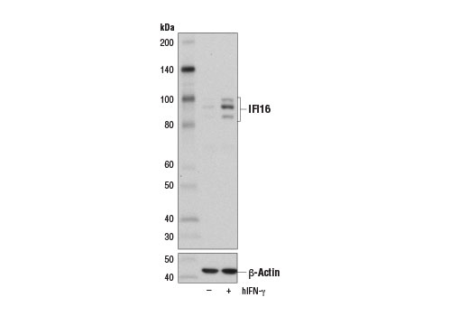 Western Blotting Image 2: IFI16 (D8B5T) Rabbit Monoclonal Antibody