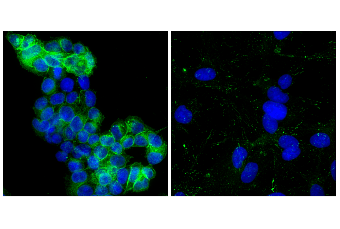 Immunofluorescence Image 1: Integrin alphaV (D2N5H) Rabbit Monoclonal Antibody