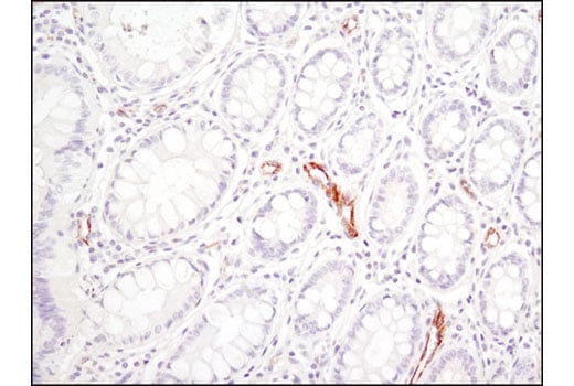 Immunohistochemistry Image 1: SPARC (D10F10) Rabbit Monoclonal Antibody
