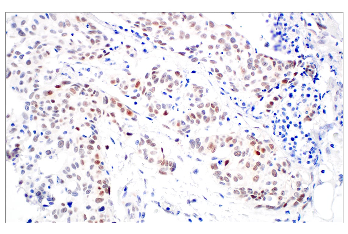 Immunohistochemistry Image 3: TCF12/HEB (E5R8X) Rabbit Monoclonal Antibody