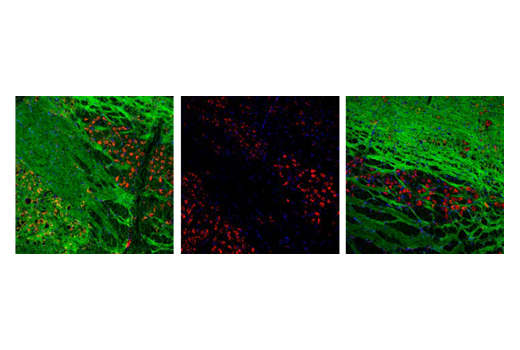 Immunofluorescence Image 1: Phospho-Tau (Thr181) (D9F4G) Rabbit Monoclonal Antibody