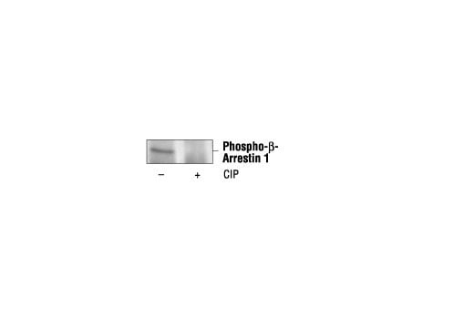 Immunoprecipitation Image 1: Phospho-beta-Arrestin 1 (Ser412) (6-24) Mouse Monoclonal Antibody