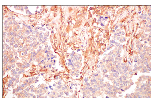 Immunohistochemistry Image 4: ILK1 (4G9) Rabbit Monoclonal Antibody
