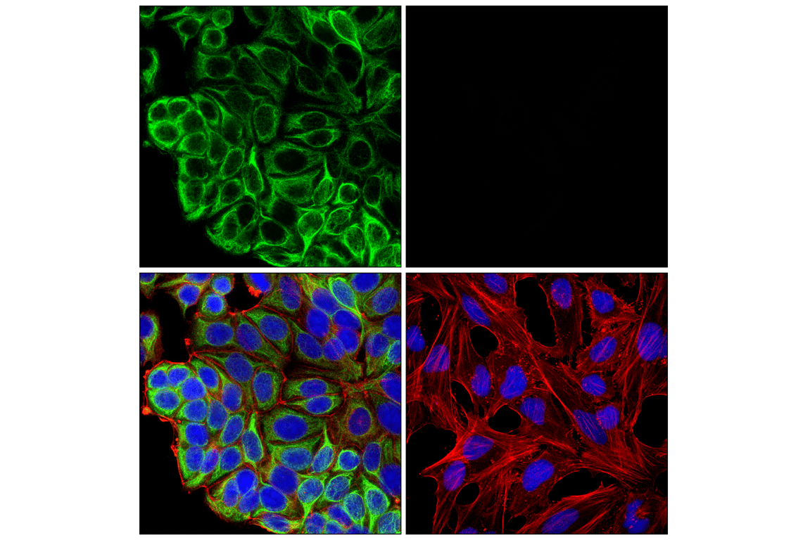 undefined Image 23: Cytokeratin Antibody Sampler Kit