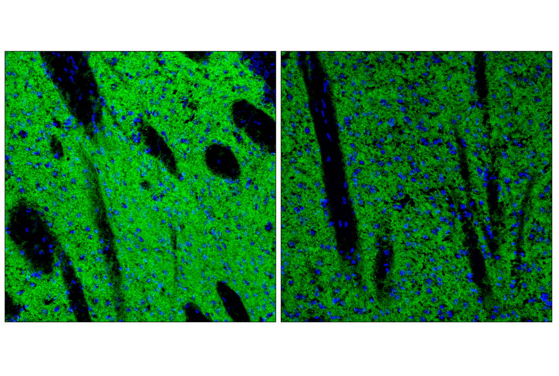 Immunofluorescence Image 2: SynGAP-alpha2 (E4Y6I) Rabbit Monoclonal Antibody