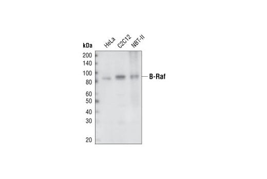 undefined Image 10: Raf Family Antibody Sampler Kit