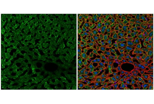 Immunofluorescence Image 2: NSUN2 (E6N6I) Rabbit Monoclonal Antibody