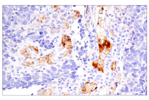 Immunohistochemistry Image 1: Fibrinogen gamma chain (E1U3Z) XP<sup>®</sup> Rabbit mAb (BSA and Azide Free)