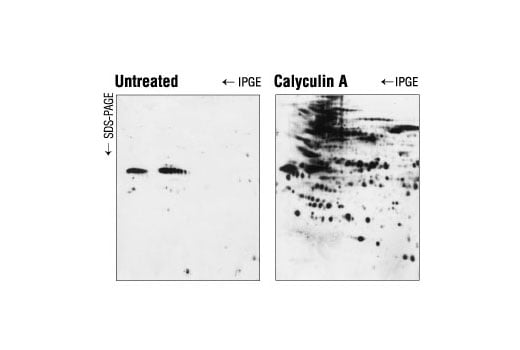 undefined Image 1: Calyculin A