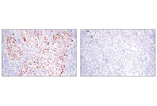 Immunohistochemistry Image 2: p14 ARF (E3X6D) Rabbit Monoclonal Antibody