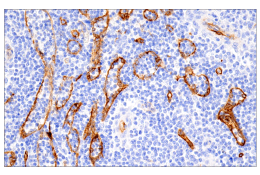 undefined Image 45: Pericyte Antibody Sampler Kit