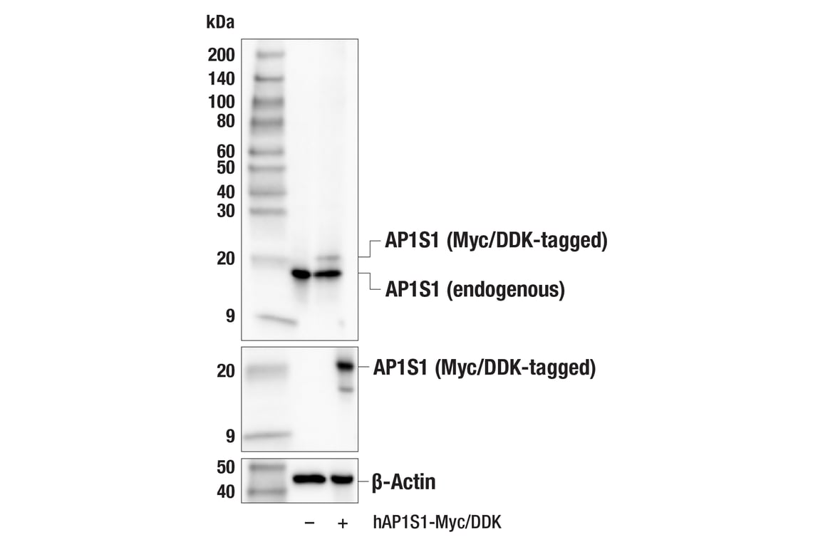 Western Blotting Image 2: AP1S1 (F8K5S) Rabbit Monoclonal Antibody