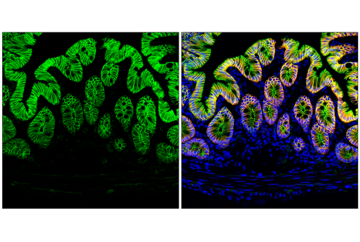 Immunofluorescence Image 1: beta-Catenin (D10A8) Rabbit Monoclonal Antibody (Alexa Fluor<sup>®</sup> 488 Conjugate)