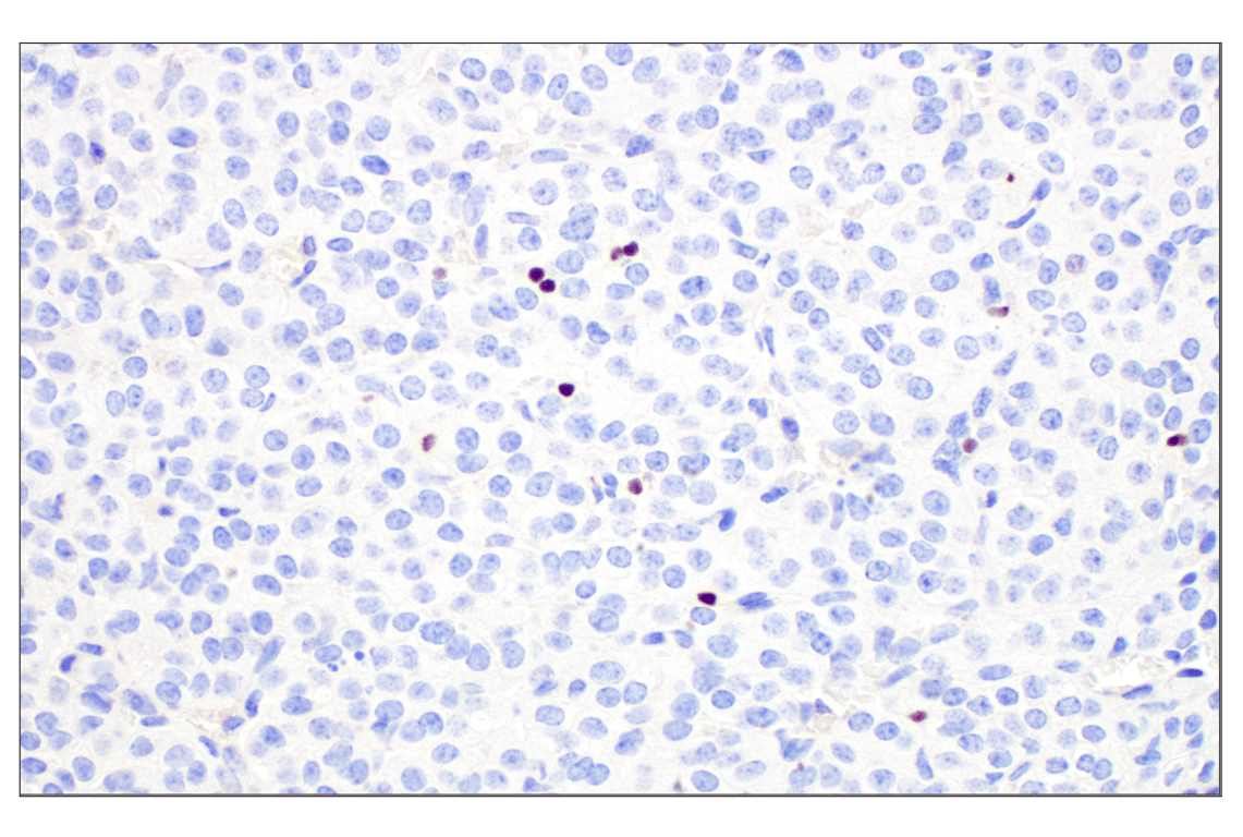 Immunohistochemistry Image 8: T-bet/TBX21 (E4I2K) Rabbit Monoclonal Antibody (BSA and Azide Free)