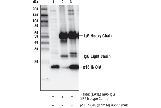 Immunoprecipitation Image 1: p16 INK4A (D7C1M) Rabbit Monoclonal Antibody