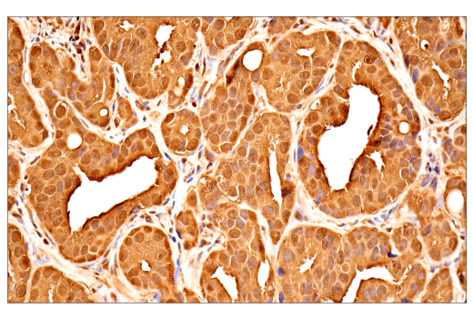 Immunohistochemistry Image 1: Ubiquitin (E6K4Y) Rabbit Monoclonal Antibody (BSA and Azide Free)