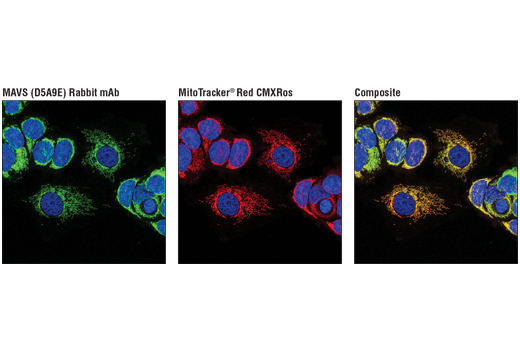 Immunofluorescence Image 1: MAVS (D5A9E) Rabbit Monoclonal Antibody
