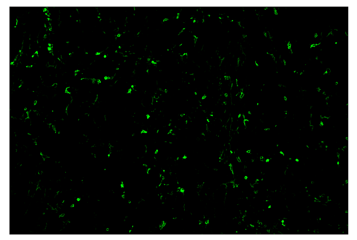 Immunohistochemistry Image 2: CD11b/ITGAM (E4K8C) & CO-0083-594 SignalStar<sup>™</sup> Oligo-Antibody Pair