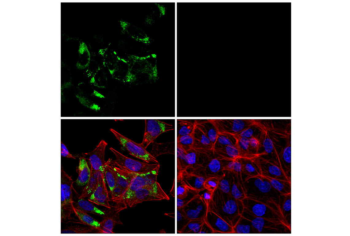 Immunofluorescence Image 1: COL3A1 (E8D7R) Rabbit Monoclonal Antibody (BSA and Azide Free)
