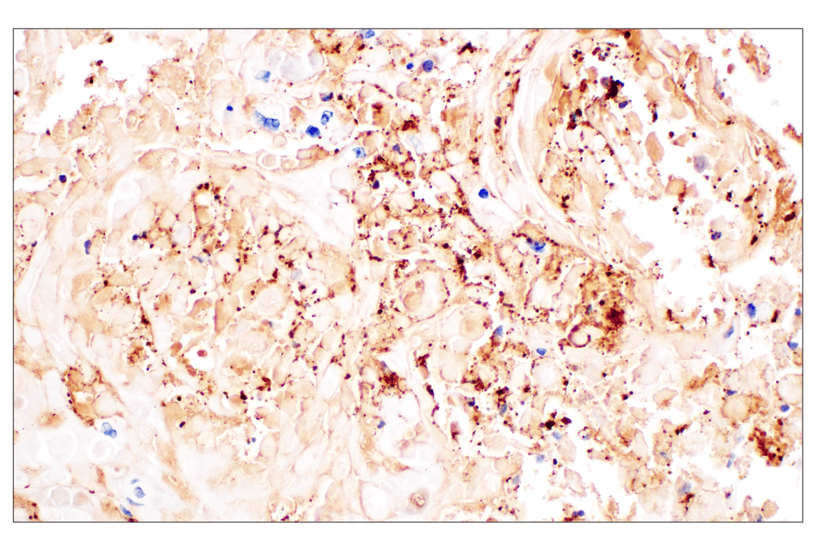 Immunohistochemistry Image 5: Citrullinated Histone H3 (Arg2) (F3C9B) Rabbit Monoclonal Antibody (BSA and Azide Free)