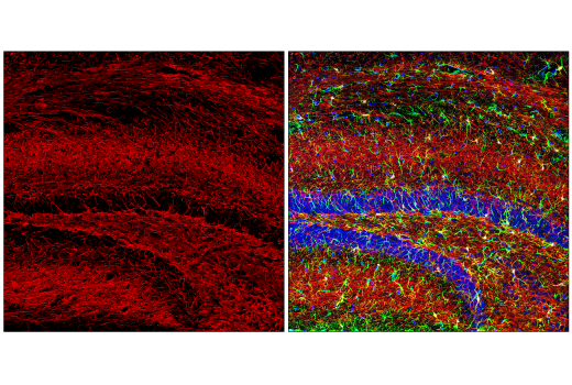 Immunofluorescence Image 1: Neurofilament-H (E7Z7G) Rabbit Monoclonal Antibody