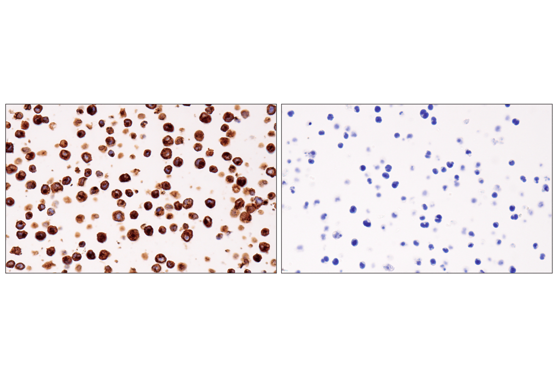 Immunohistochemistry Image 11: HLA-DRA (E9R2Q) Rabbit Monoclonal Antibody