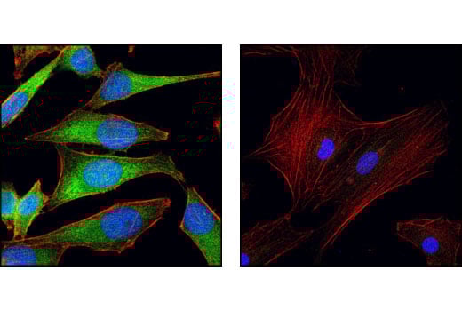 Immunofluorescence Image 1: NQO1 (A180) Mouse Monoclonal Antibody