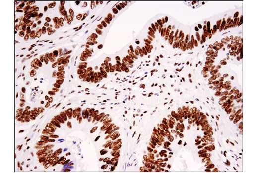 Immunohistochemistry Image 2: Tri-Methyl-Histone H3 (Lys36) (D5A7) Rabbit Monoclonal Antibody (BSA and Azide Free)