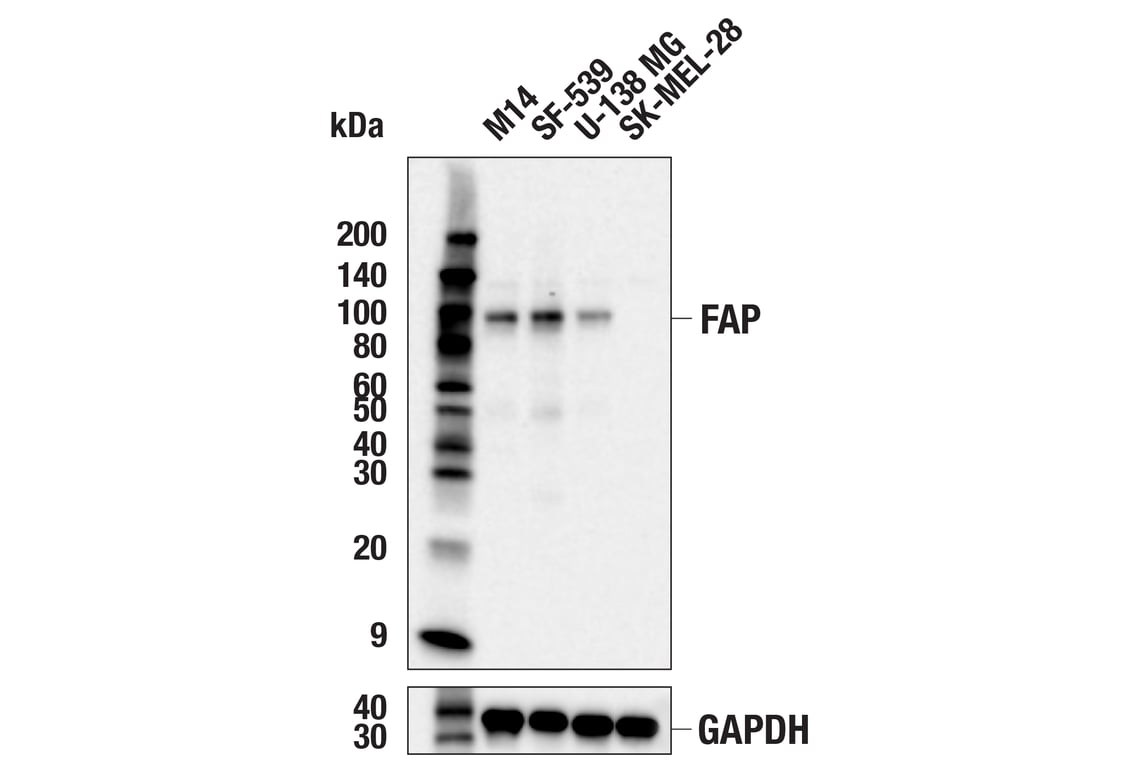 Western Blotting Image 2: FAP (F1A4G) Rabbit Monoclonal Antibody (BSA and Azide Free)