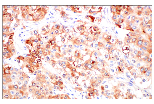 Immunohistochemistry Image 1: FGL1 (E7C1Q) Rabbit Monoclonal Antibody