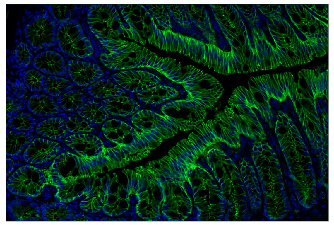 Immunohistochemistry Image 2: beta-Catenin (D10A8) Rabbit Monoclonal Antibody (Alexa Fluor<sup>®</sup> 488 Conjugate)