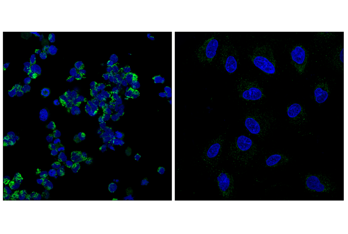 Immunofluorescence Image 1: GCDH (F2P2M) Rabbit Monoclonal Antibody