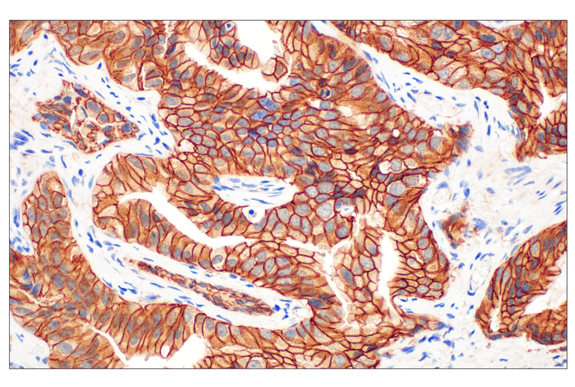 Immunohistochemistry Image 1: beta-Catenin (D10A8) Rabbit Monoclonal Antibody