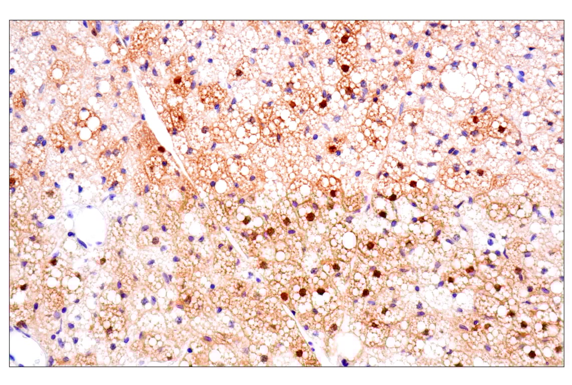 Immunohistochemistry Image 14: ACBP/DBI (E4V8V) Rabbit Monoclonal Antibody
