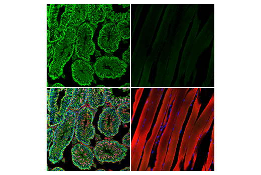 Immunofluorescence Image 1: MIF (E8S8H) Rabbit Monoclonal Antibody