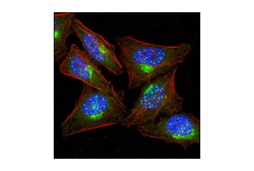 Immunofluorescence Image 1: PKA C-alpha Antibody