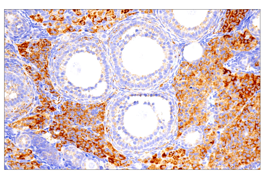 Immunohistochemistry Image 2: Maoa (E3L3B) Rabbit Monoclonal Antibody