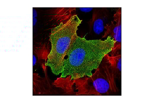 Immunofluorescence Image 1: TRA-1-81 (TRA-1-81) Mouse Monoclonal Antibody